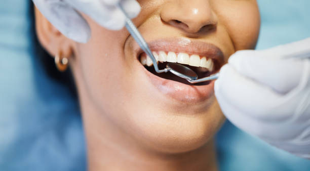 Best Dentist for Tooth Abscess  in Sacramento, CA
